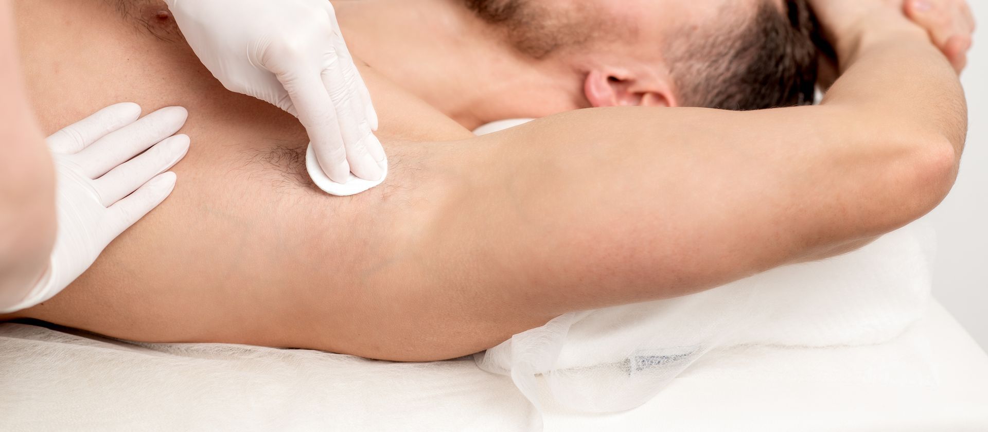 A man is getting a hair removal treatment on his underarm.