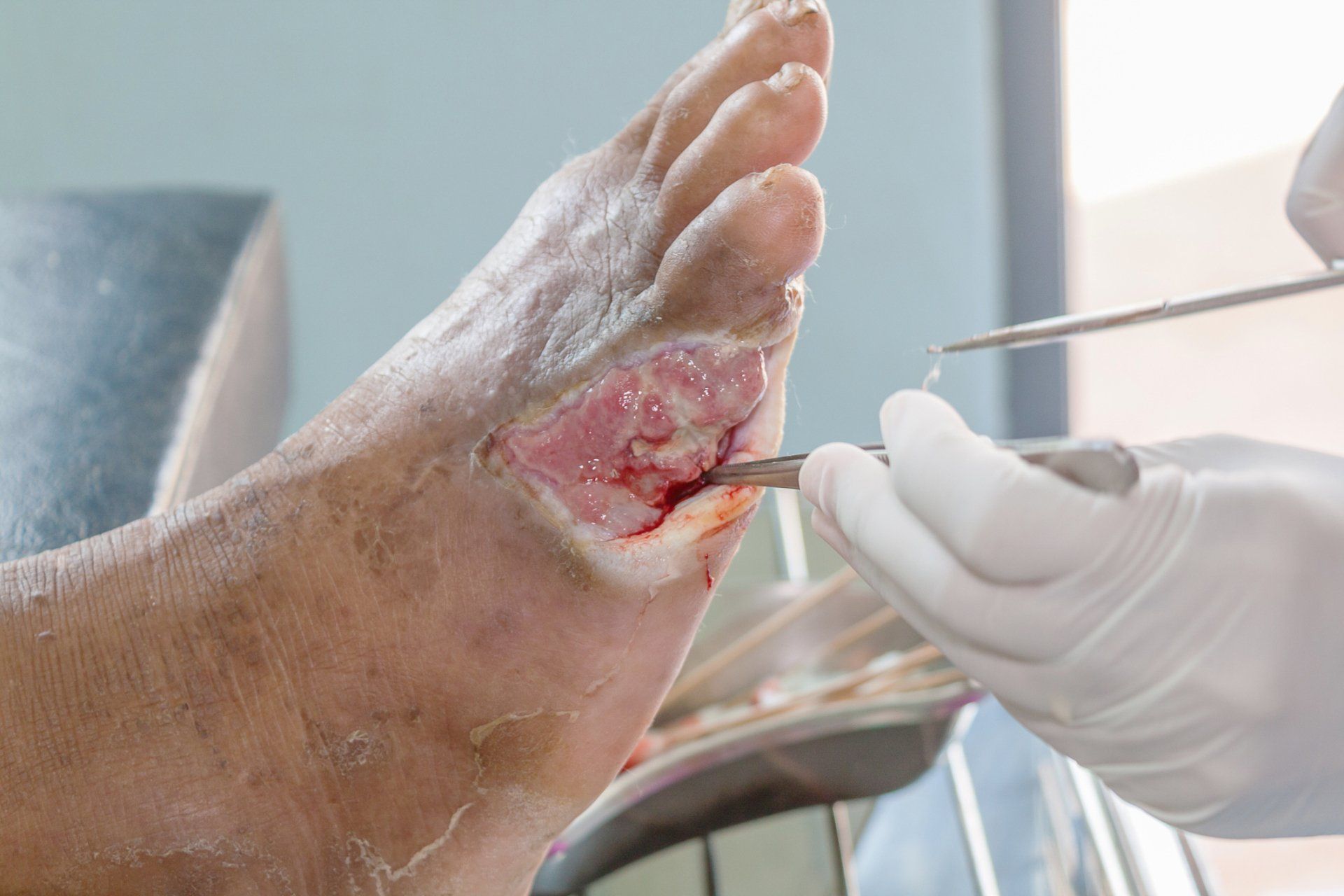 Types of Wounds — Jacksonville, FL — Wells Surgical Services LLC