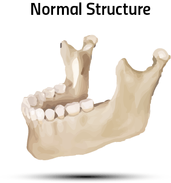 Normal Structure