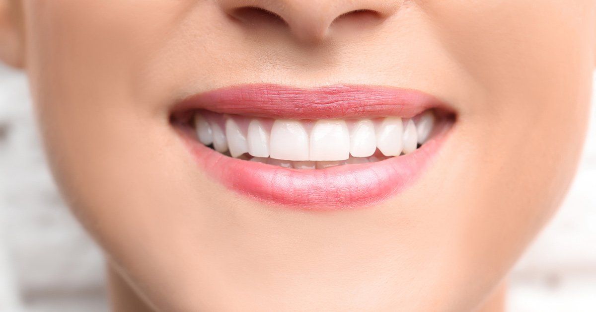 A Brief Guide to Dental Bonding