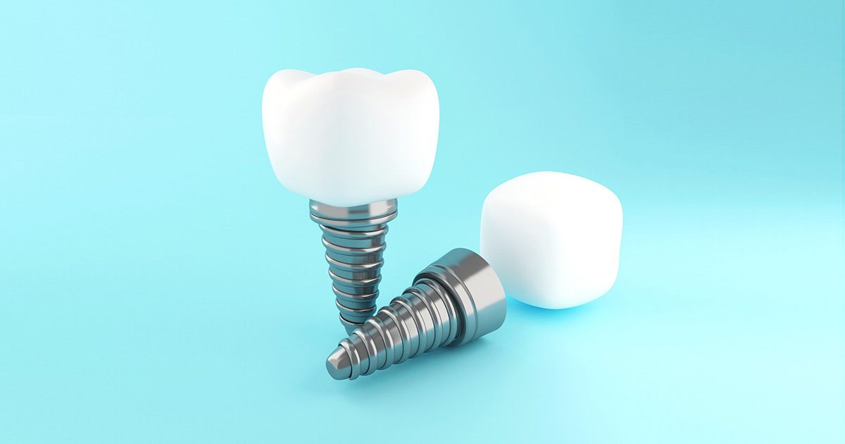 benefits of dental implants, dentist in South Philadelphia, PA