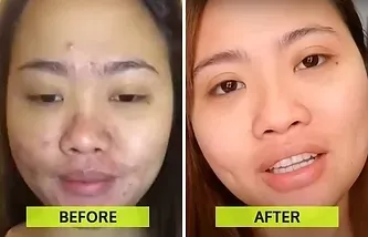 A before and after photo of a woman 's face