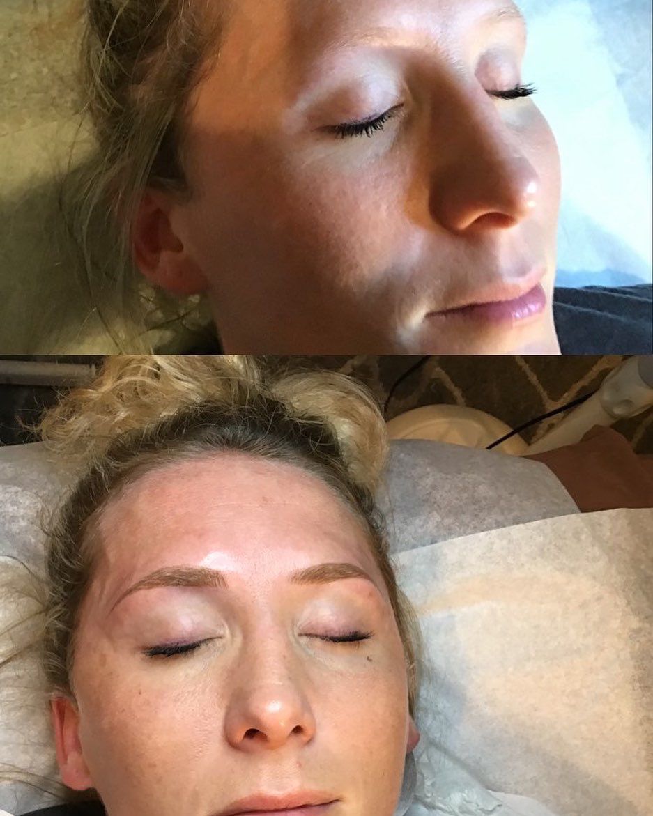 A before and after picture of a woman 's face with her eyes closed.