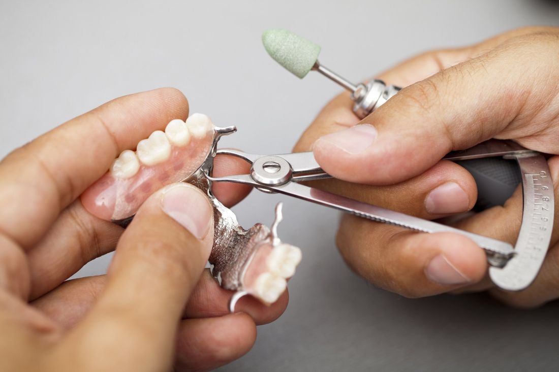 protesi dentarie mobili