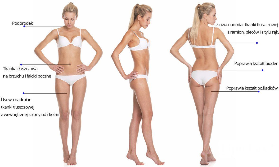 Lipoliza Iniekcyjna Lipoliza Iniekcyjna