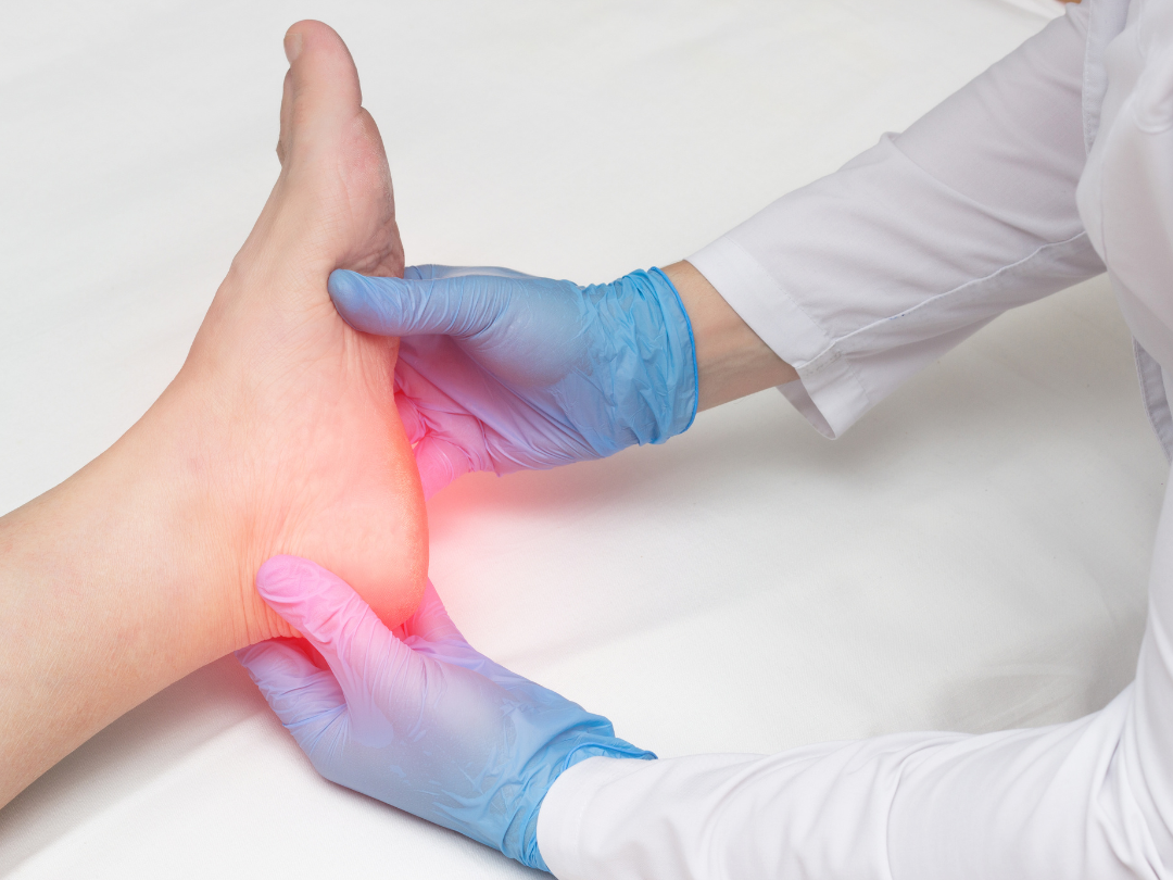 Plantar Fasciitis and Medical Laser Therapy