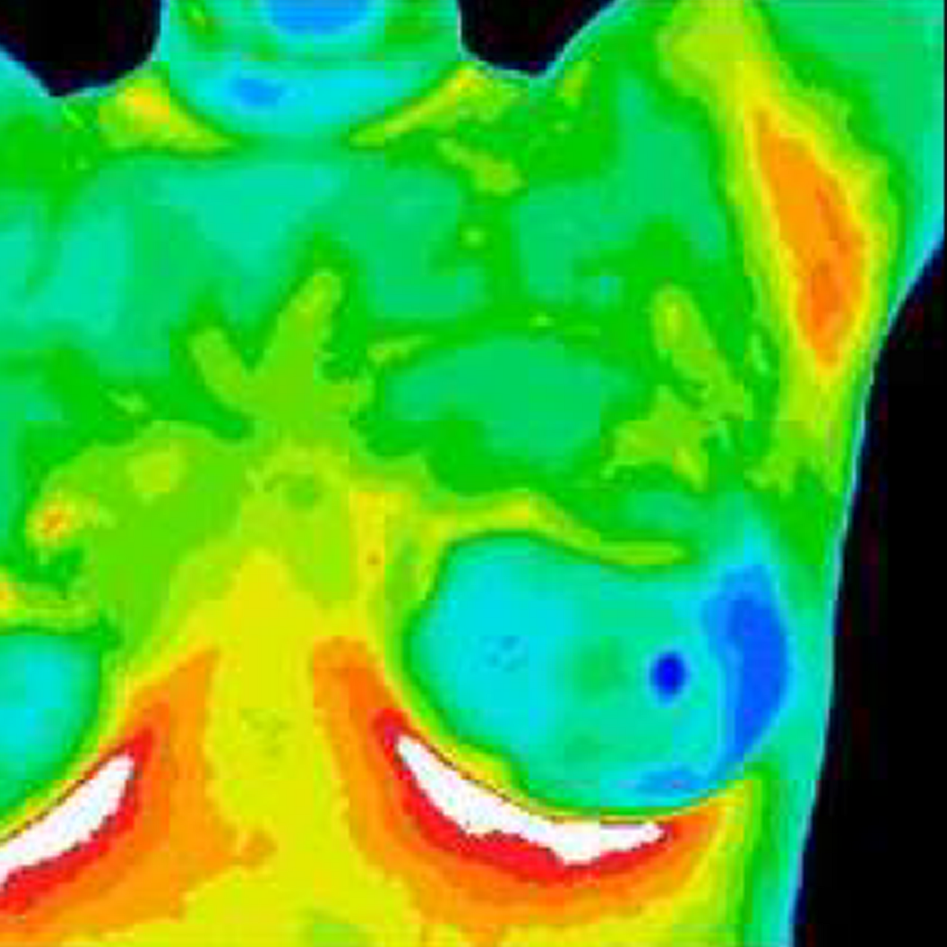 Thermal imaging