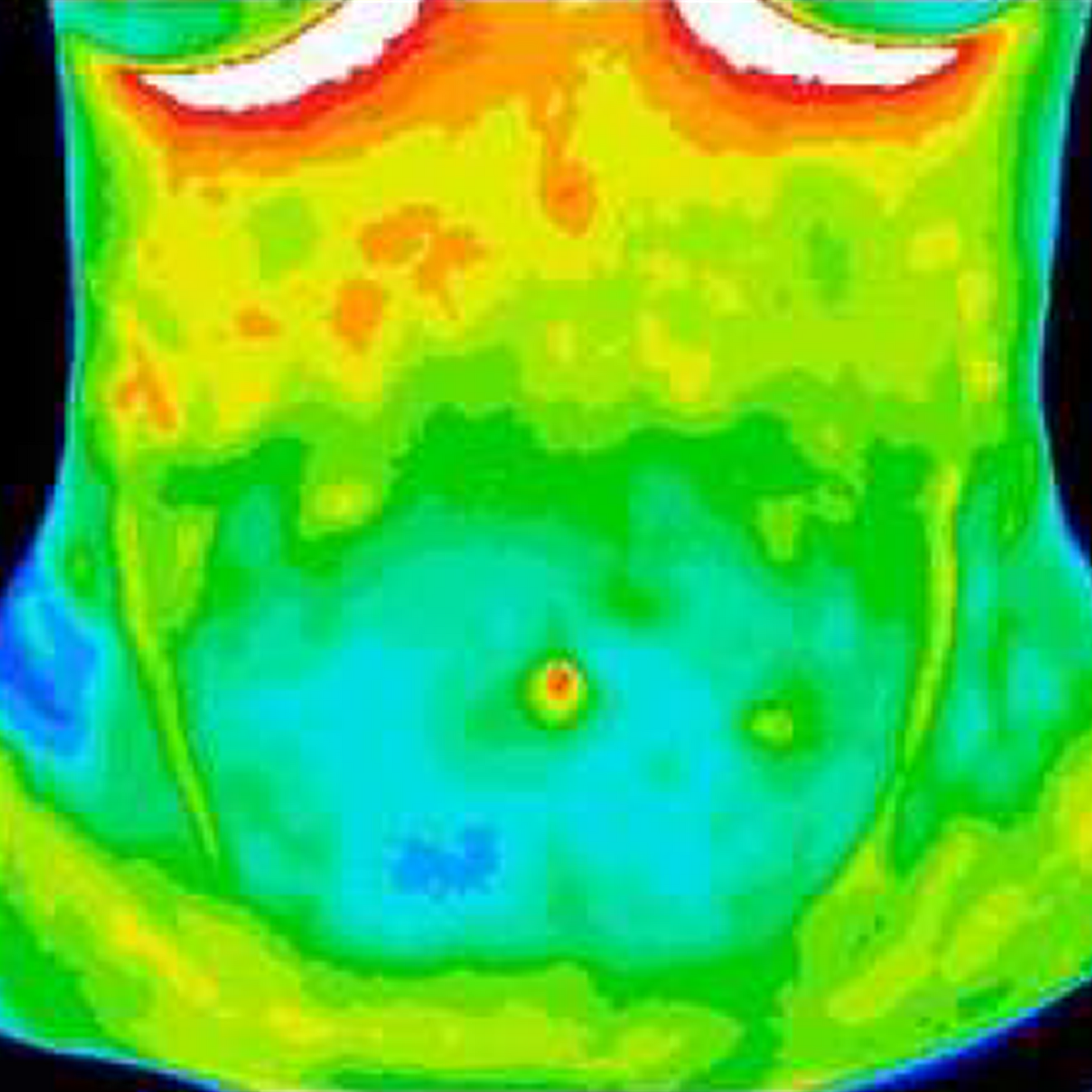 Thermal imaging of a stomach