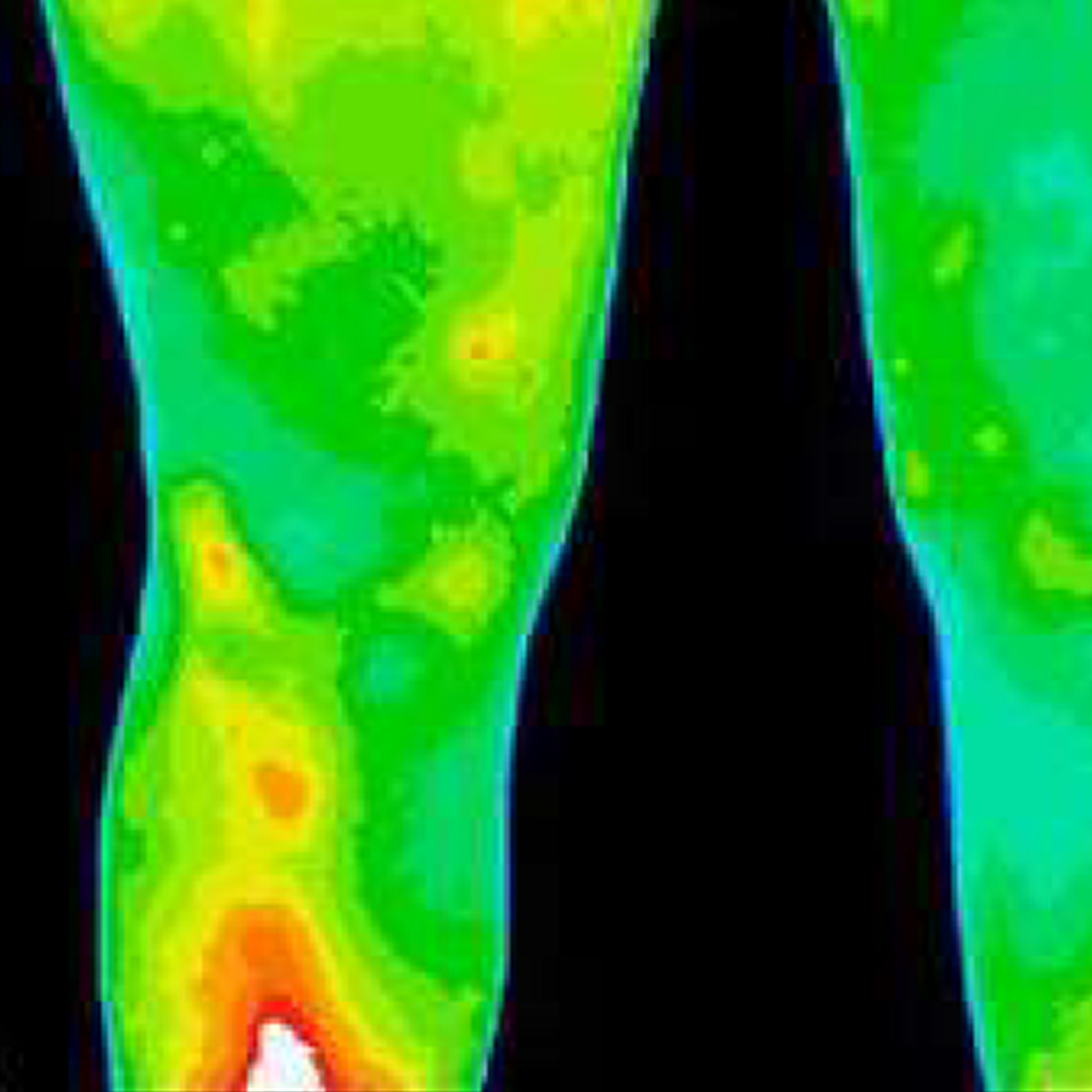 Thermal imaging of a leg