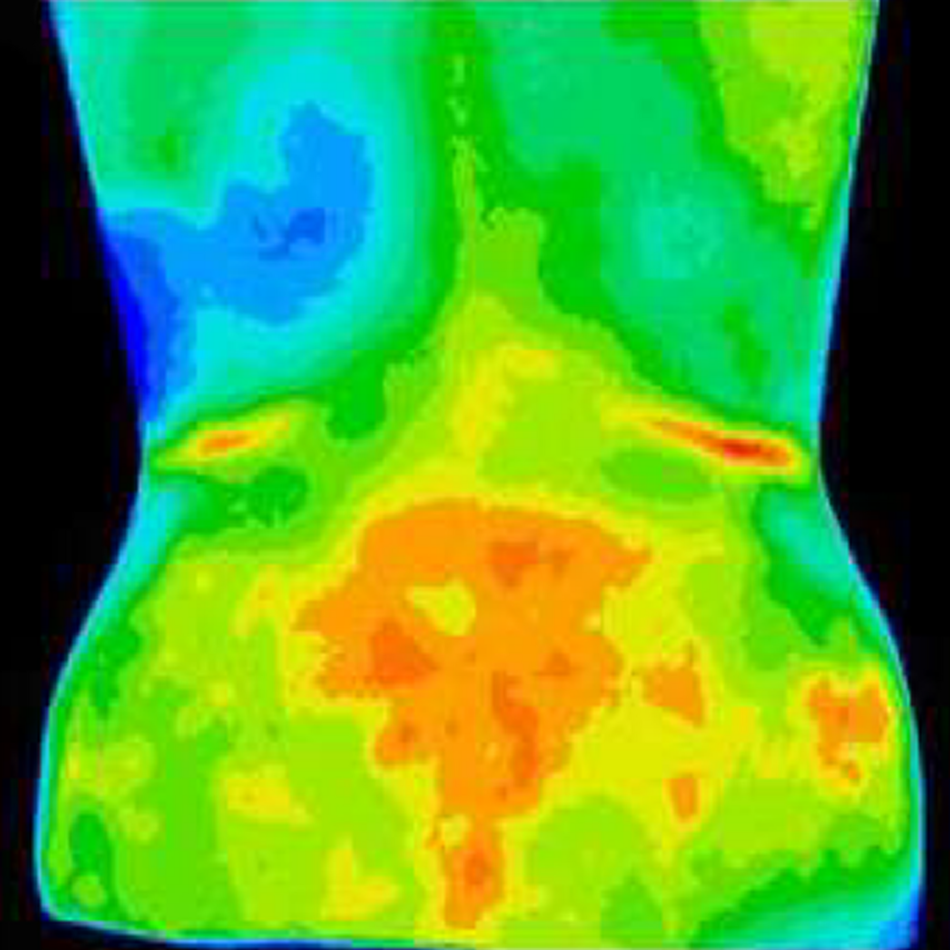 Thermal imaging of a back