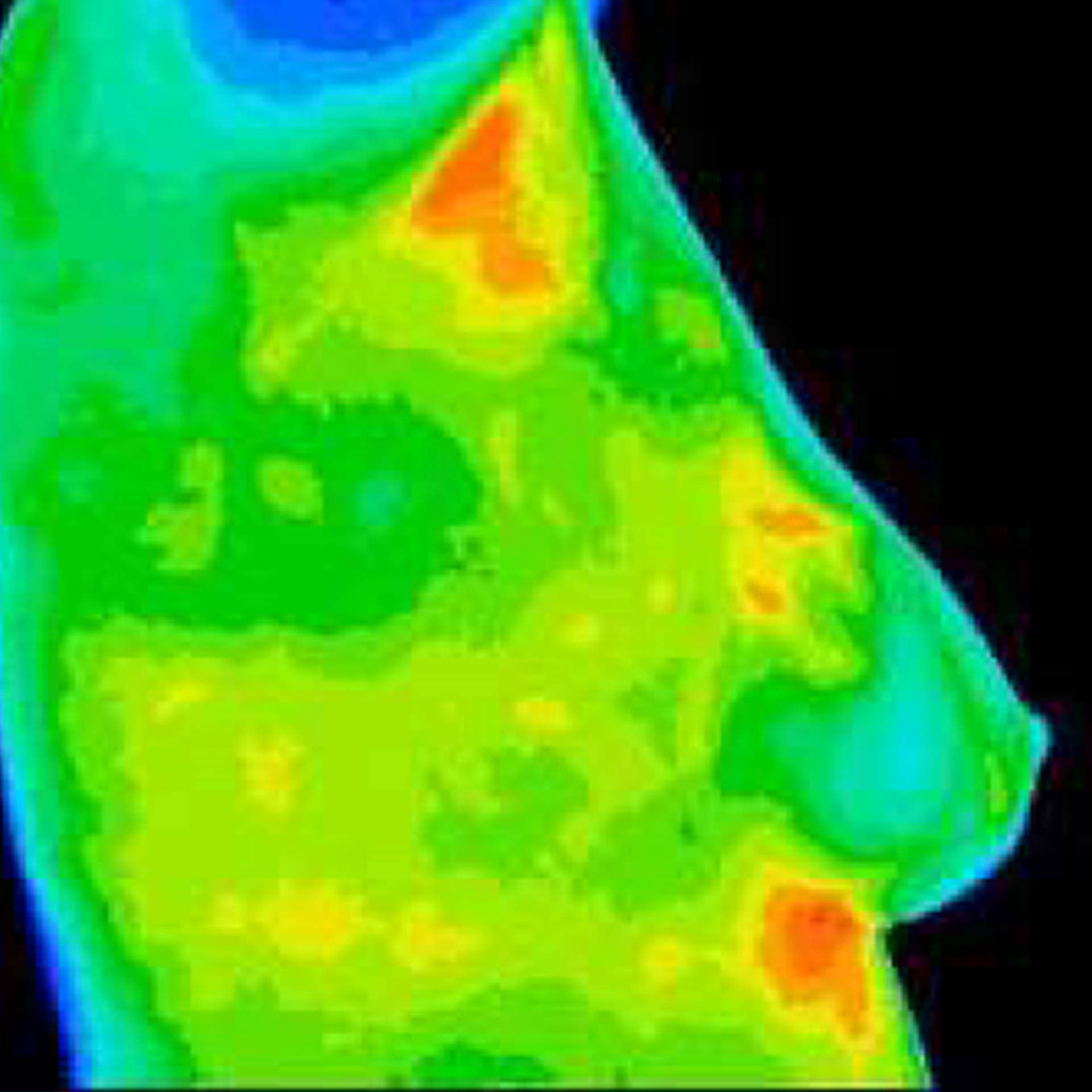 Thermal imaging of a chest