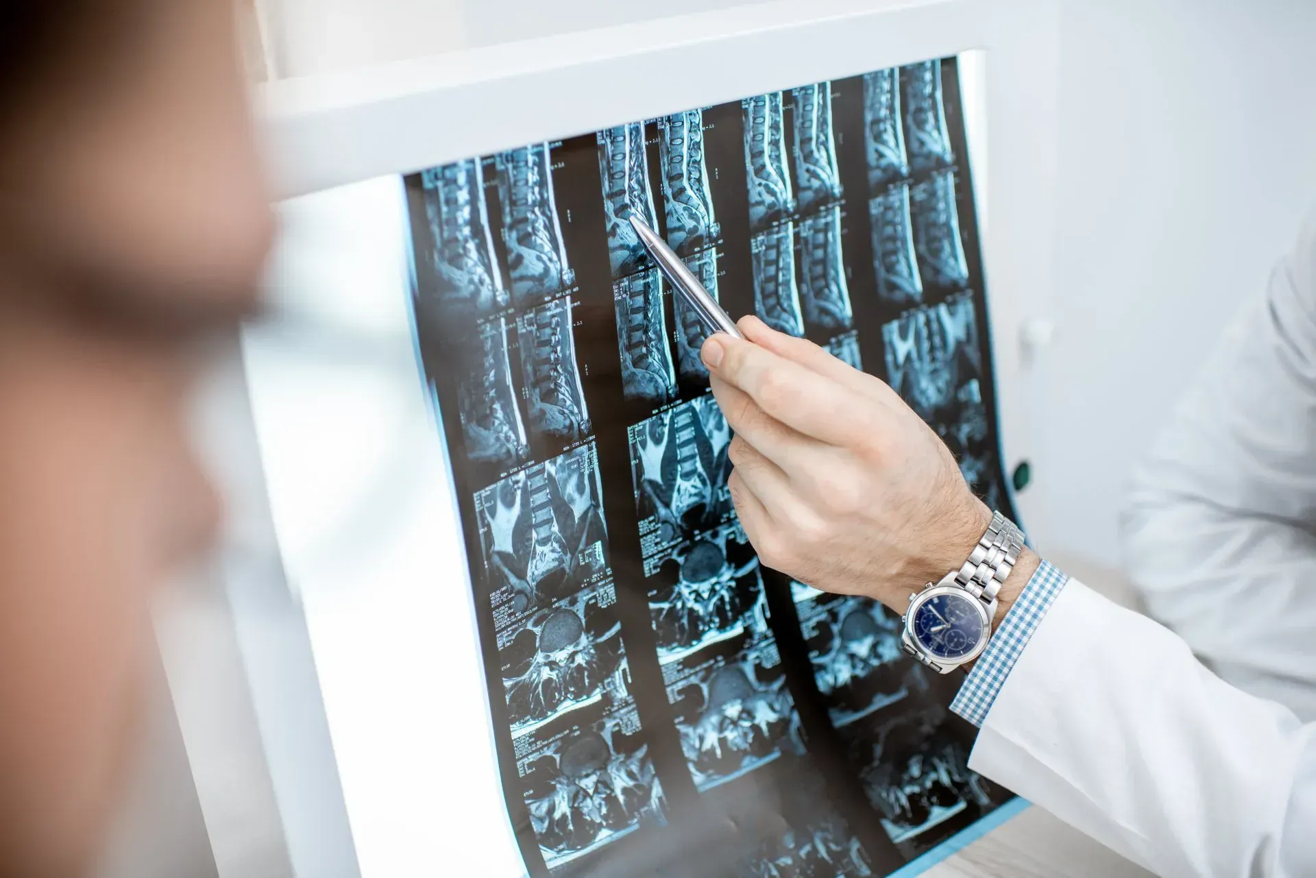 A doctor is pointing at an x-ray of the spine.