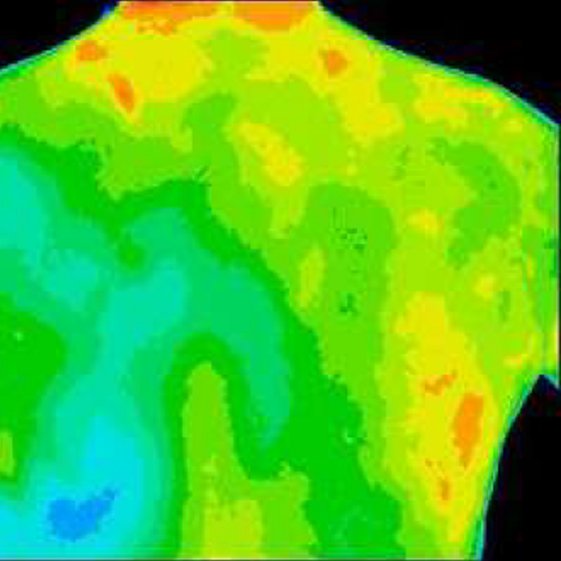 A thermal image of a person 's back and chest.