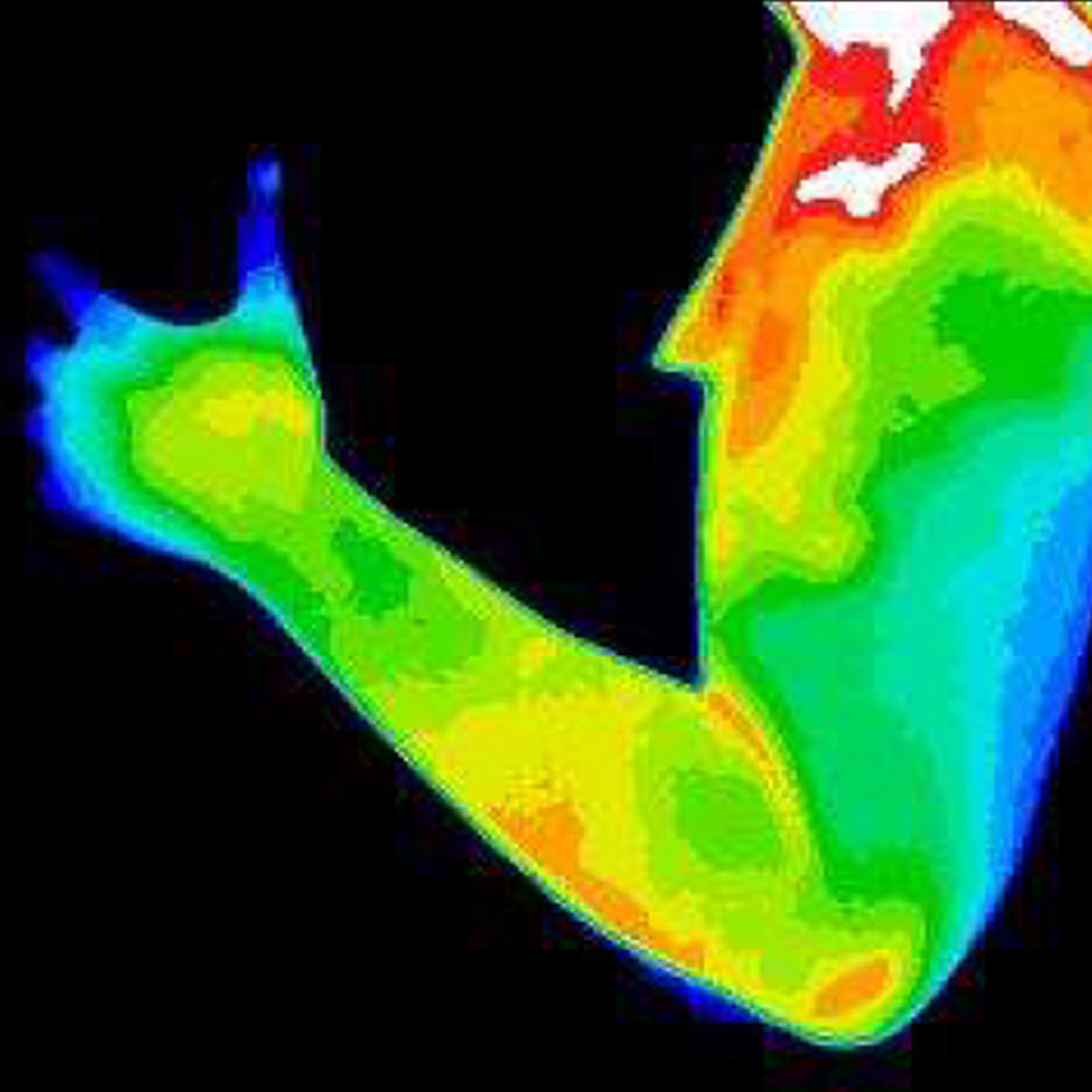 Thermal imaging of an arm