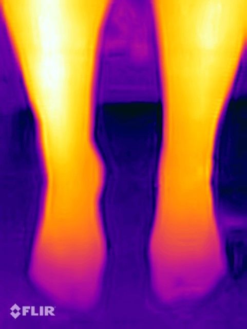 A pair of feet are shown in a thermal image.