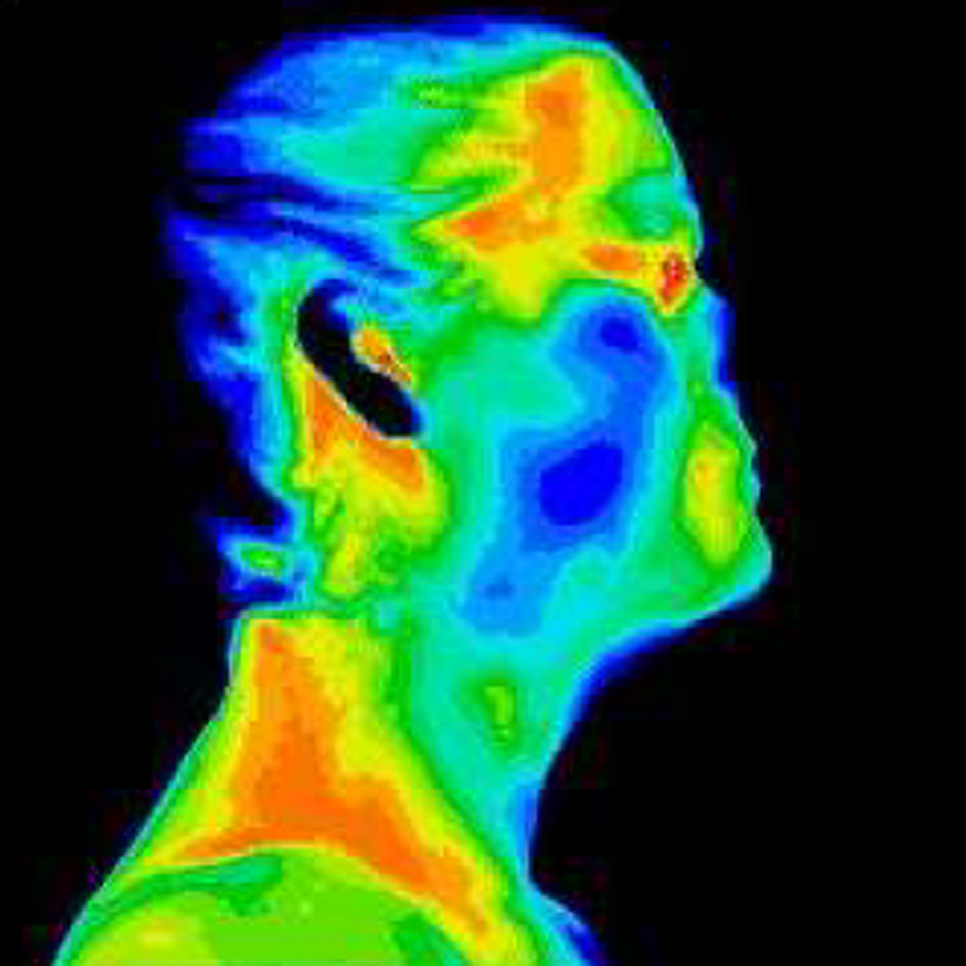 A thermal image of a person 's face and neck.
