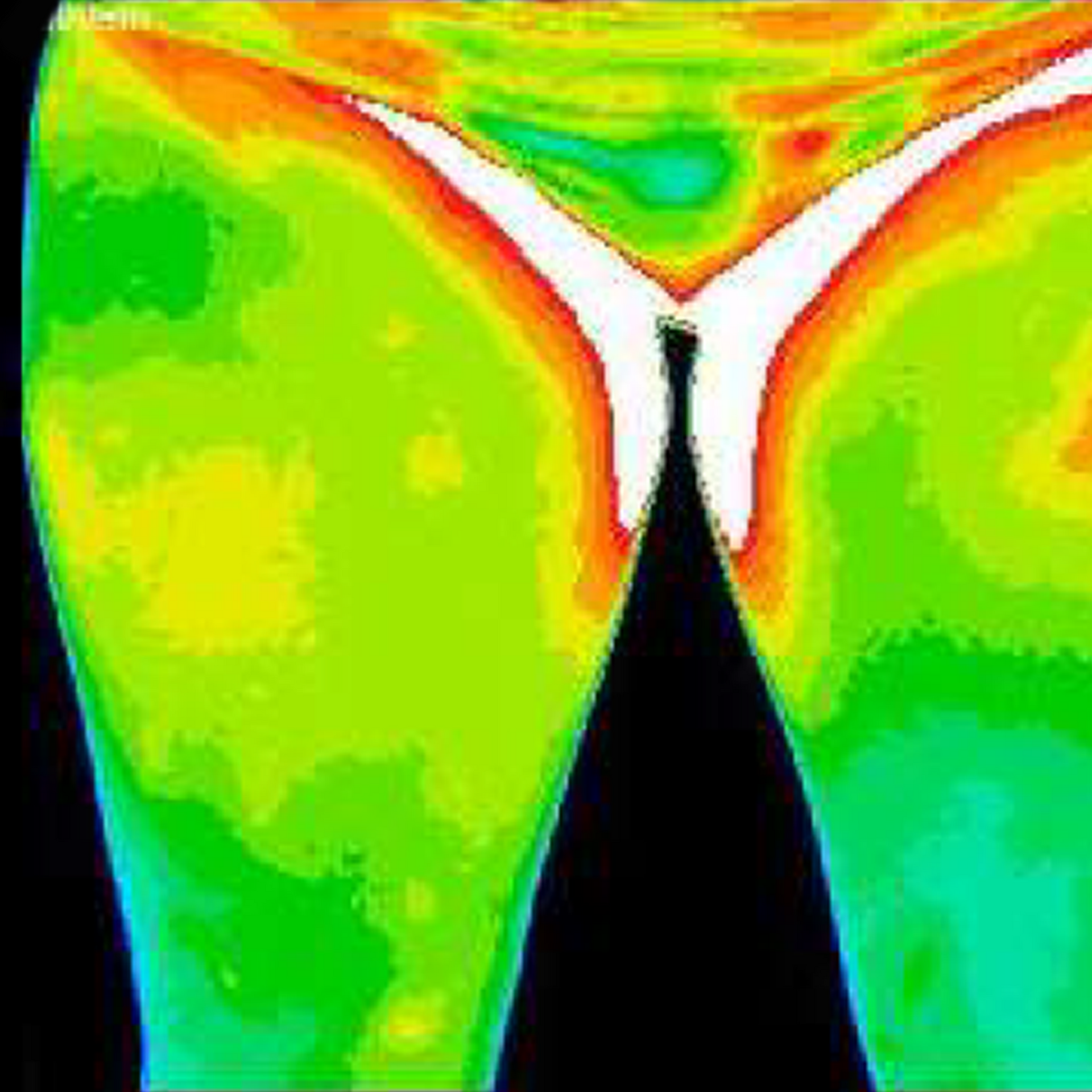 Thermal imaging of thighs