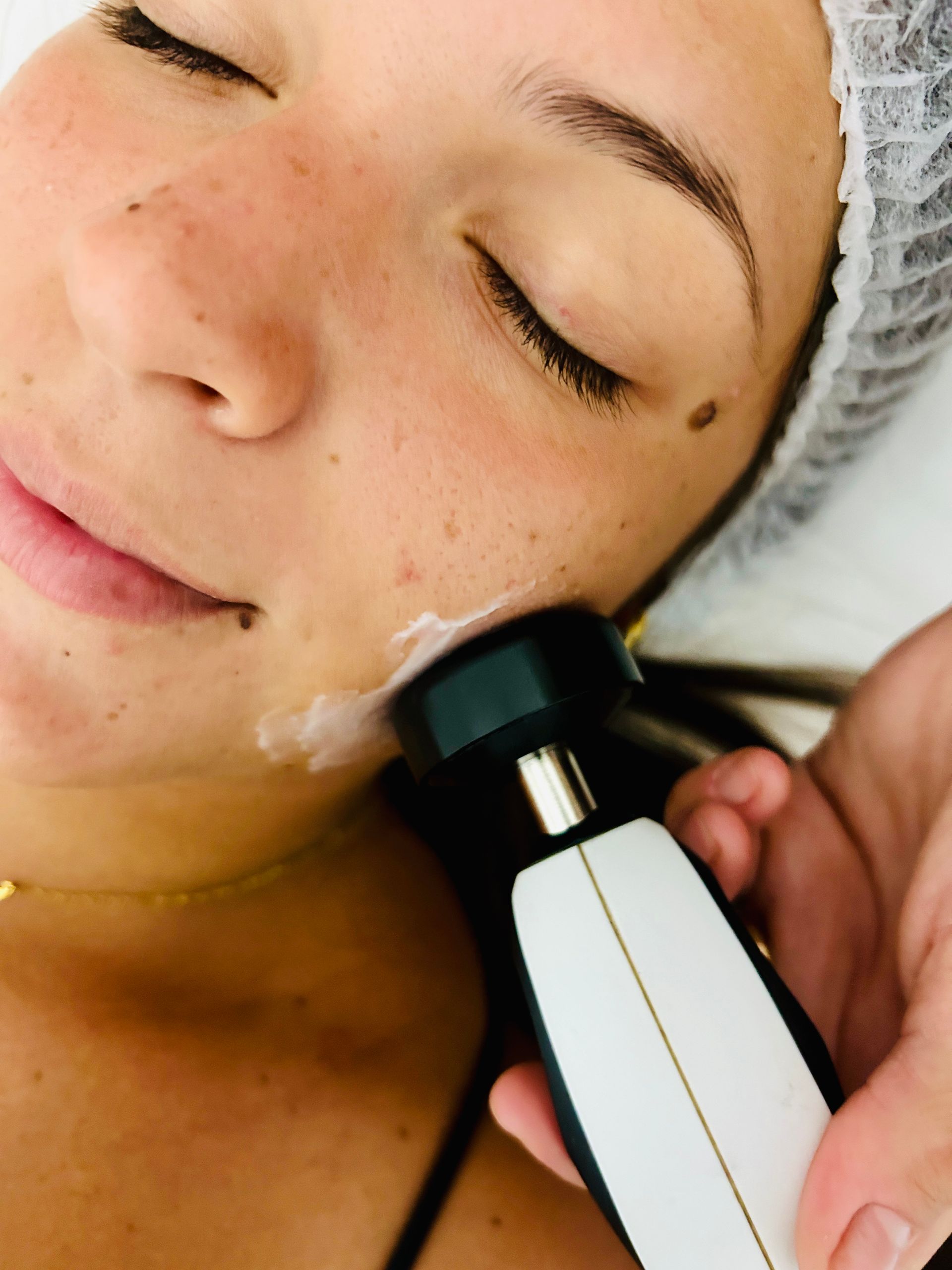 trattamenti estetici classici