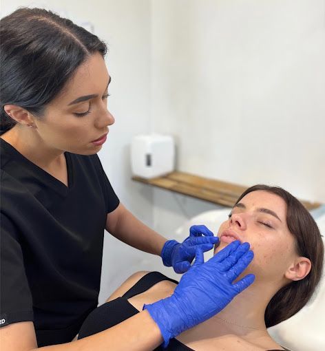 Beautiful Young Woman with Clean Fresh Skin — Cosmetic Clinic in Wollongong, NSW