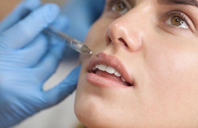 Lip Filler Application — Cosmetic Clinic in Wollongong, NSW