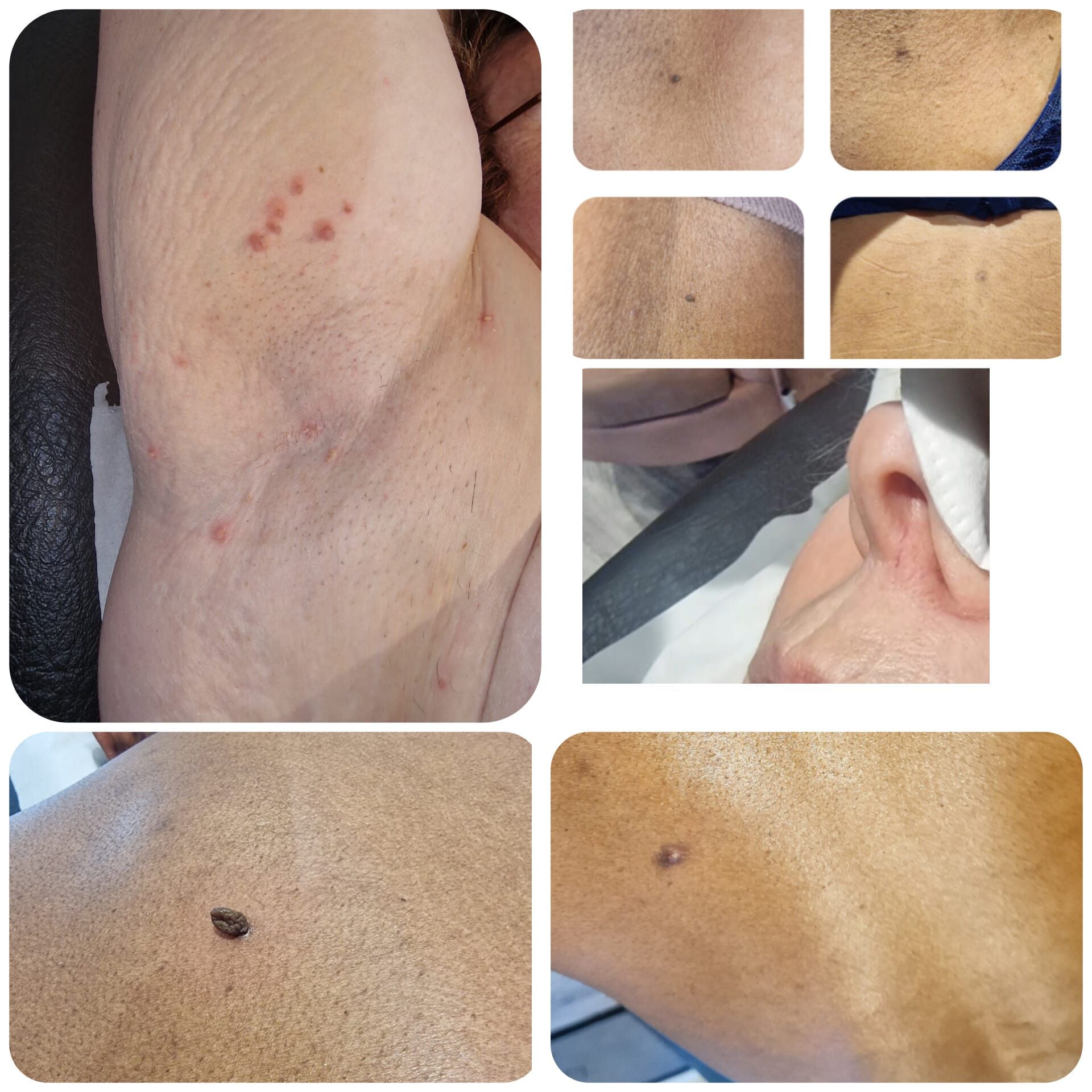 Image from BLH- with permission