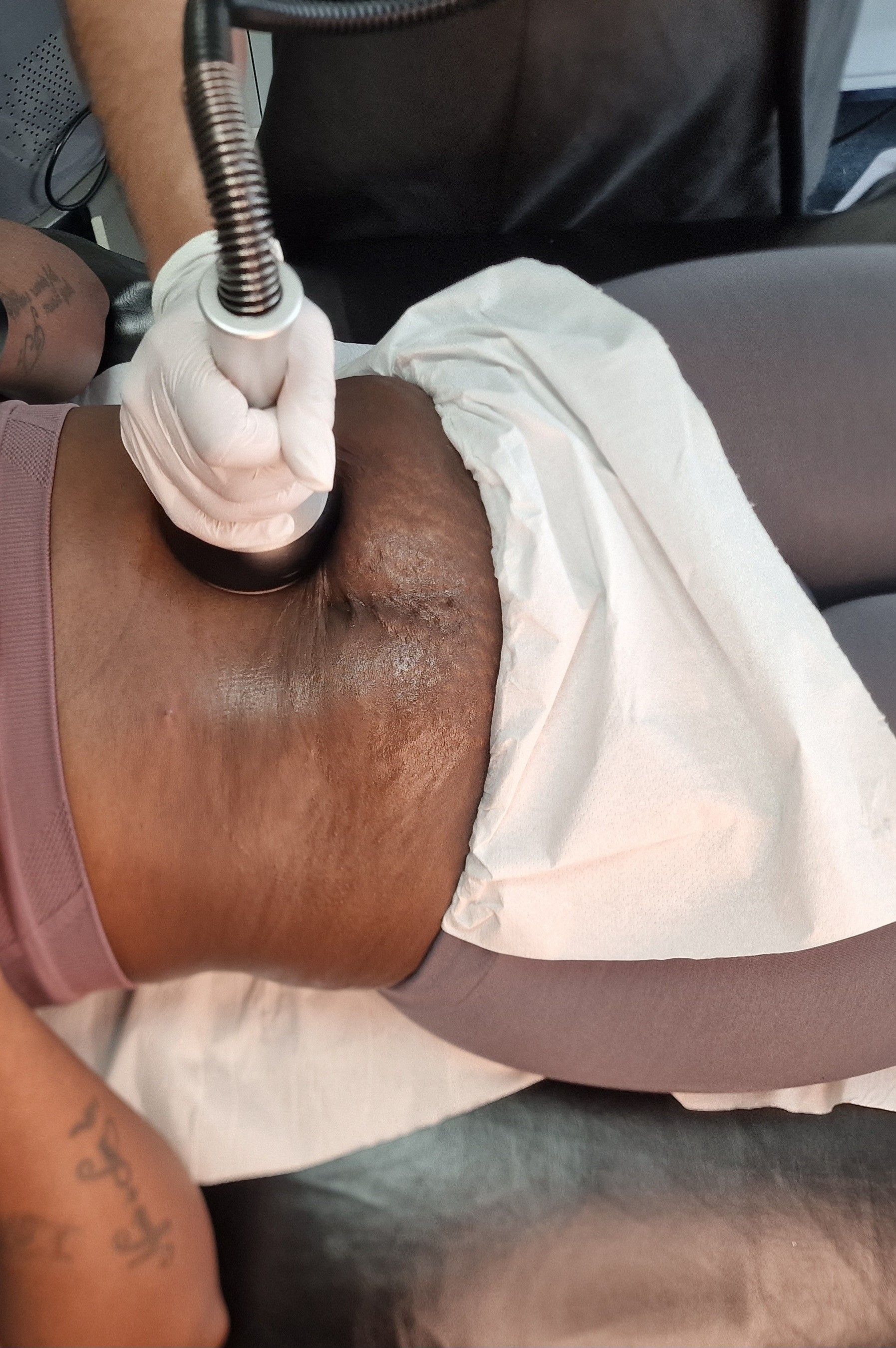 A woman is putting pink kinesio tape on a man 's shoulder.