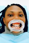Woman at dentist, mouth open with retractor, revealing teeth. Blue dental sheet, indoor setting.
