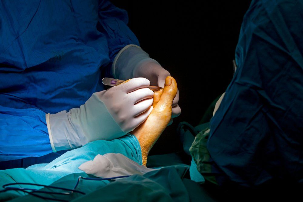 Ingrown Toenail Surgery — Acacia Podiatry in Parap, NT