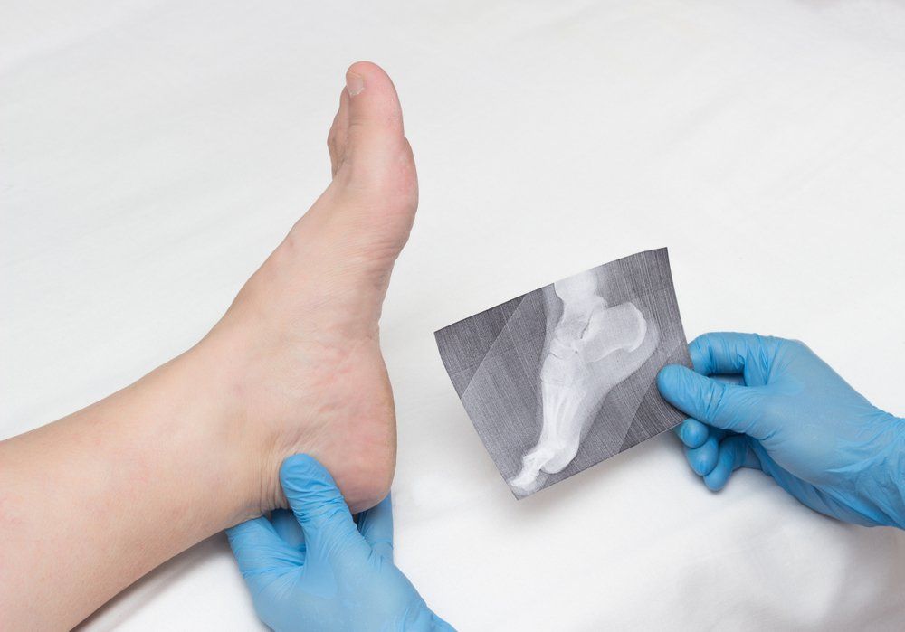 Ankle Pain — Acacia Podiatry in Parap, NT