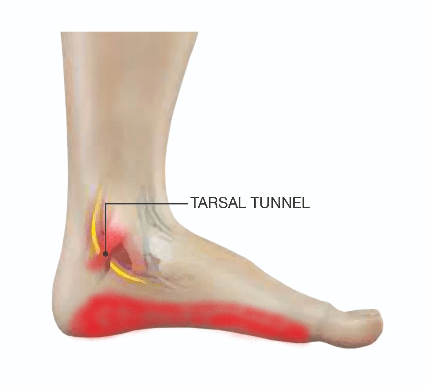 Foot ankle Pain - Acacia Podiatry in Palmerston, NT