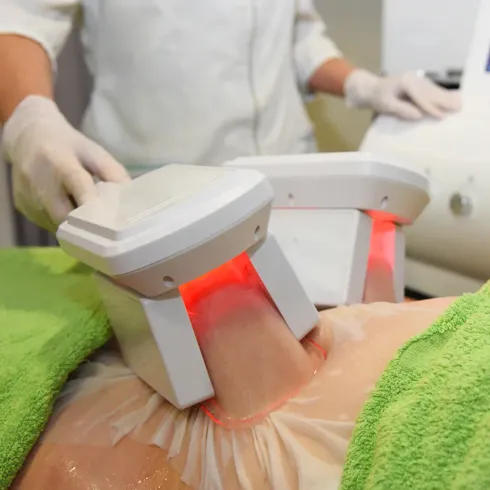 A person undergoing CoolSculpting treatment on their abdomen; two applicators are placed on the skin.