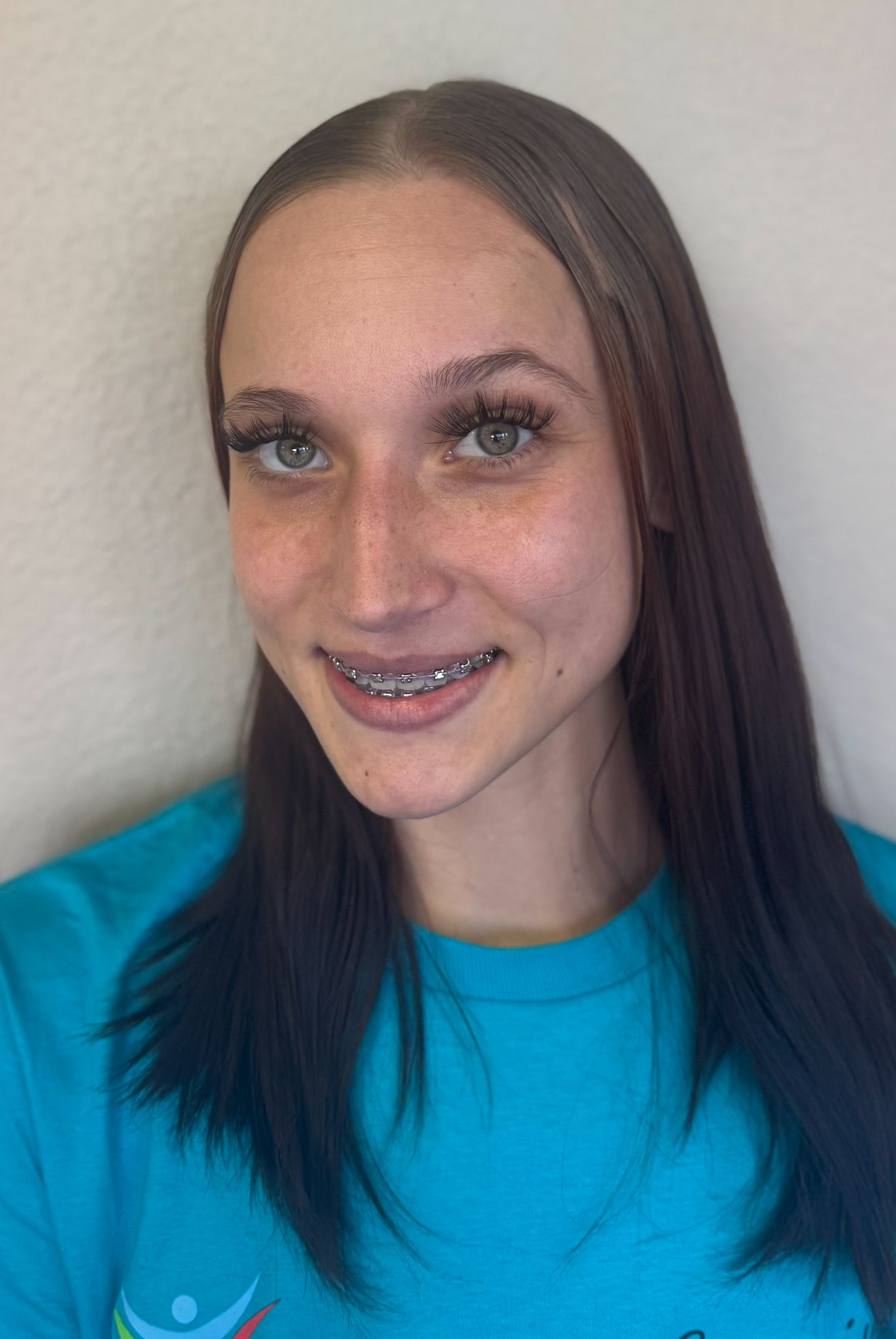 Young woman with brown hair, braces, and a teal shirt smiling at the camera.