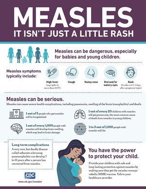 Measles