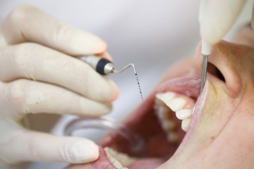 OralID Oral Cancer Screenings