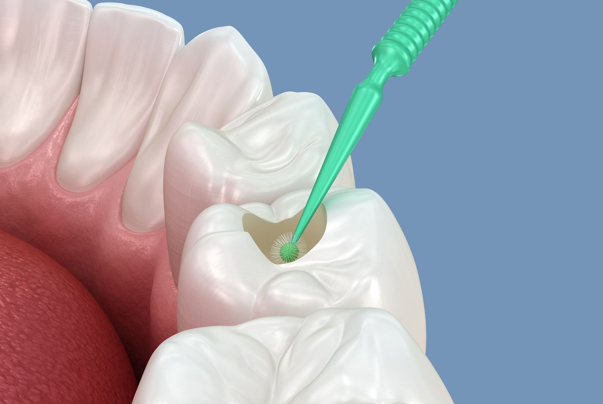 Young patient smiles at dentist in office, holding teeth mold.