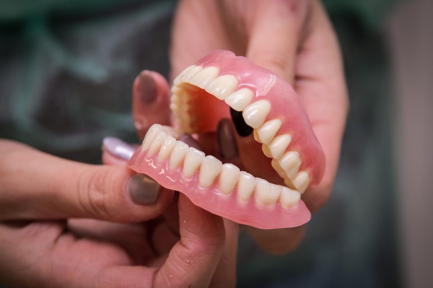A Woman is Holding a Model of Her Teeth in Her Hands — Jaw Gear Dental Prosthetics in Mittagong, NSW