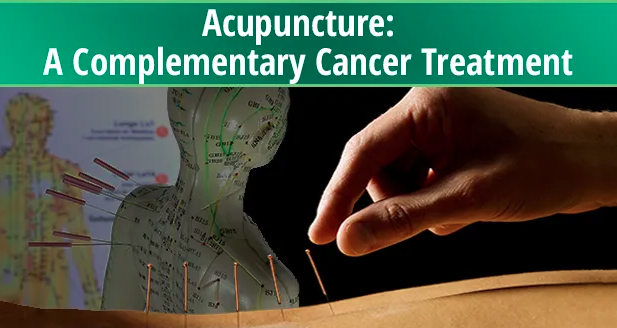 image of acupuncture as a complementary cancer treatment