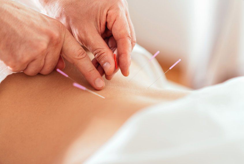 low back acupuncture treatment in omaha nebraska