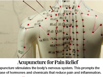 Unraveling the Connection: Acupuncture and the Nervous System