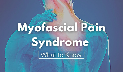 myofascial pain syndrome infographic
