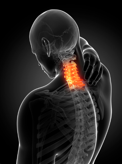 image of neck pain patient