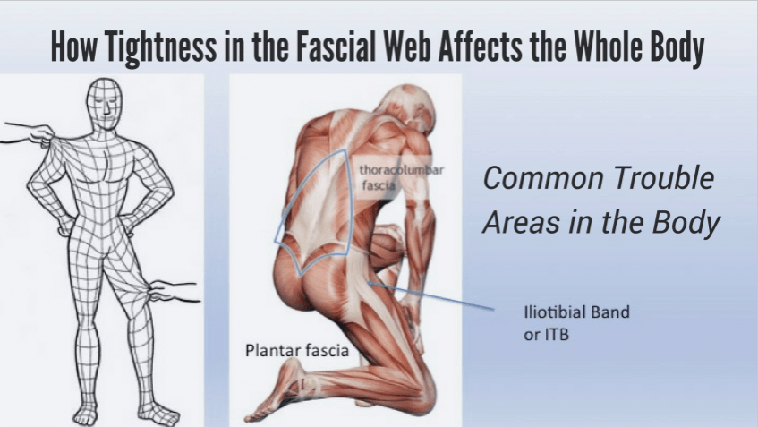 image if myofascial muscles