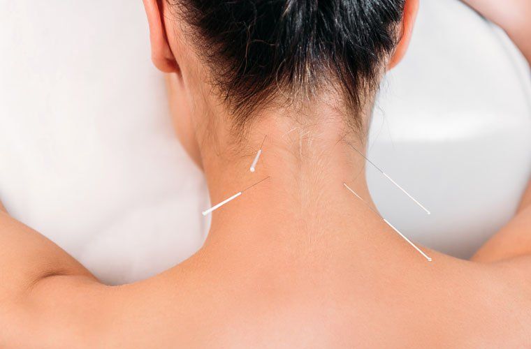 Acupoint Family Wellness Acupuncture