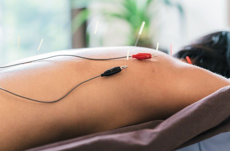 Acupoint Family Wellness Electro Acupuncture