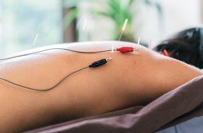 Acupoint Family Wellness Electro-Acupuncture
