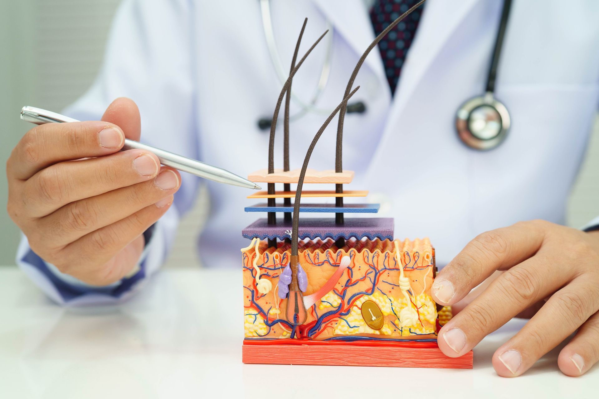 A medical professional explaining hair follicles, tissue layers, and dermatological conditions.
