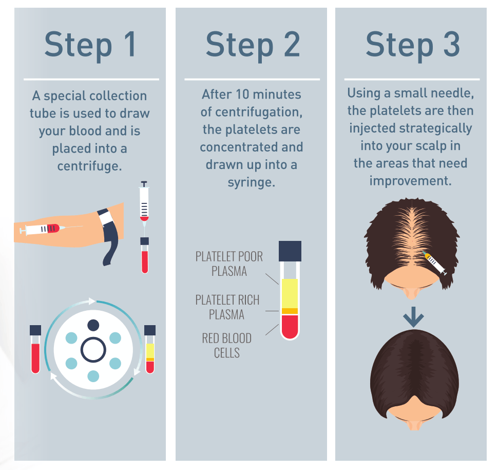 Hair Growth Steps — Shelby, MI — Drs. Berry, Tessler & Aronovitz