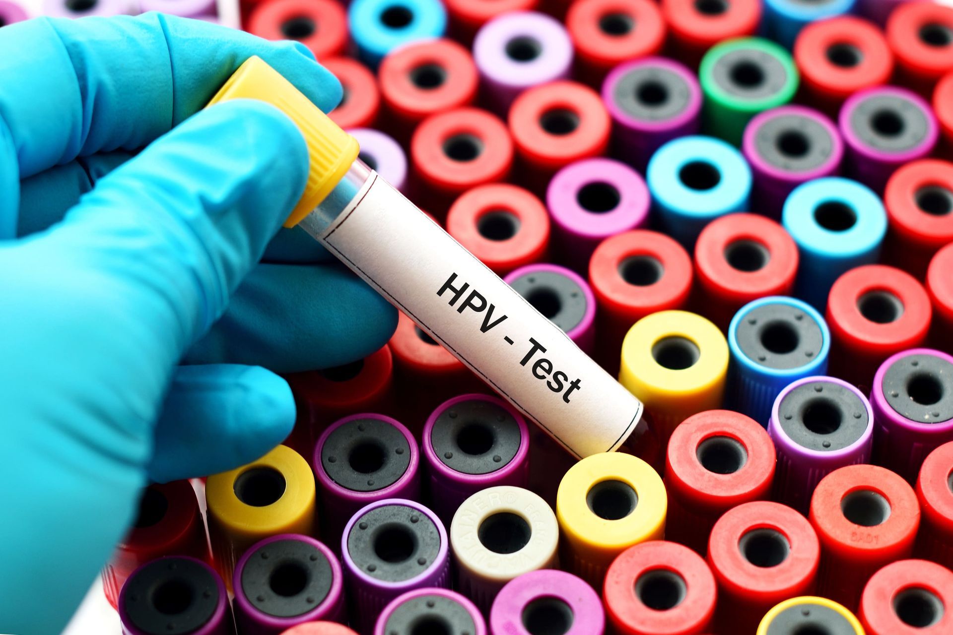 HPV o que é, sintomas e trata mentos
