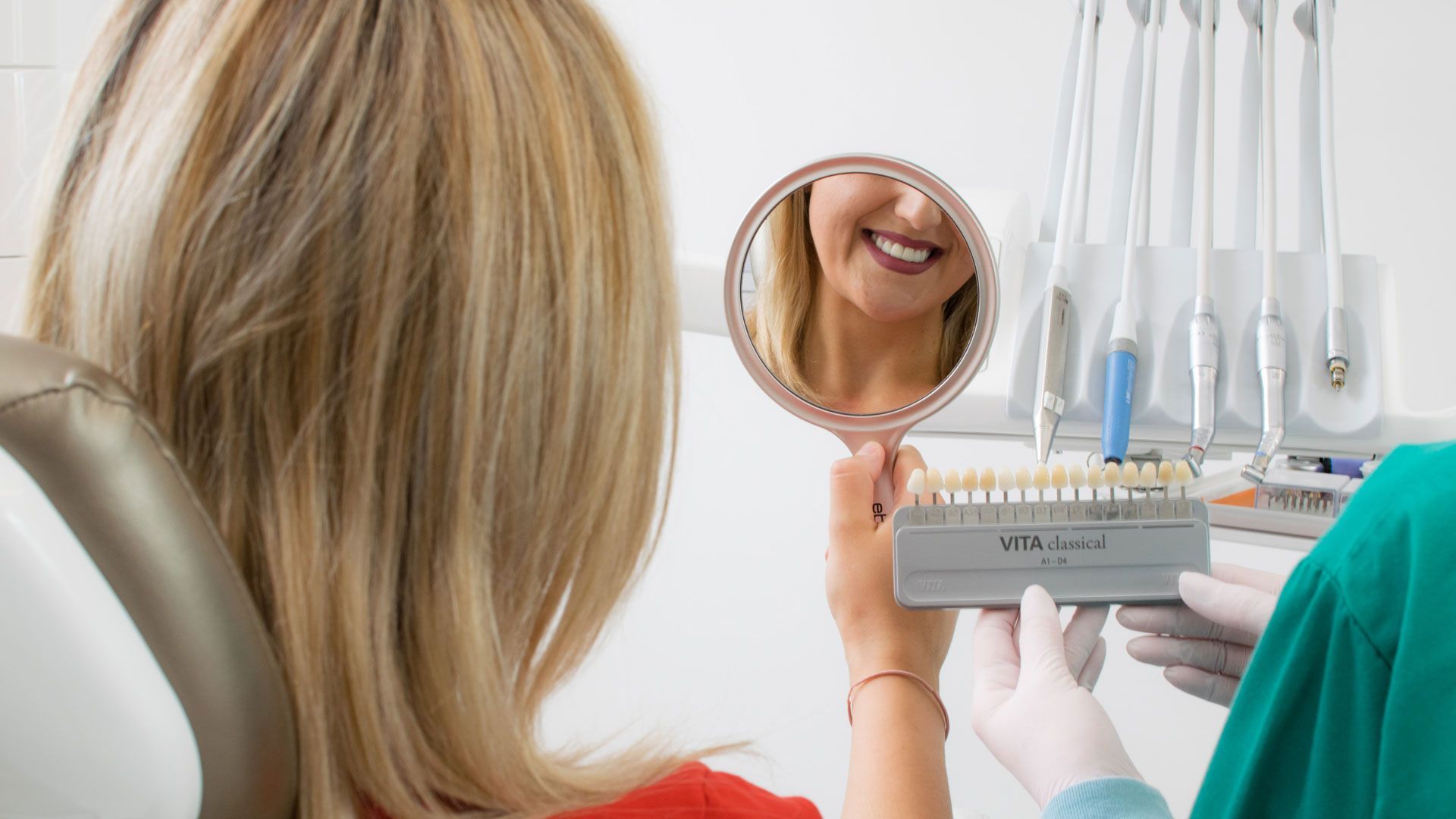 Faccette dentali: esempio e spiegazione di cosa sono e come funzionano.