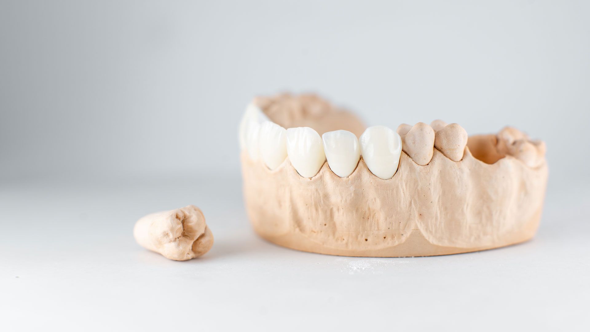 Faccette dentali in Croazia